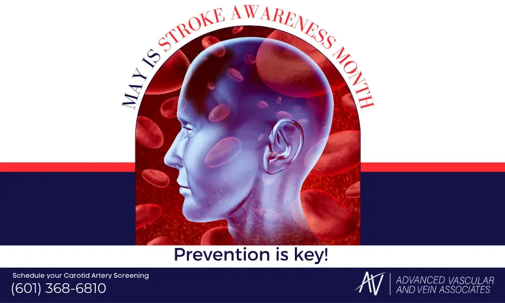 May is stroke awareness month.